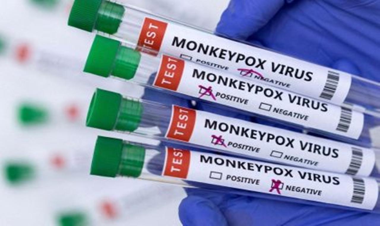 Três Lagoas descarta dois casos da Varíola Monkeypox e notifica mais um suspeito