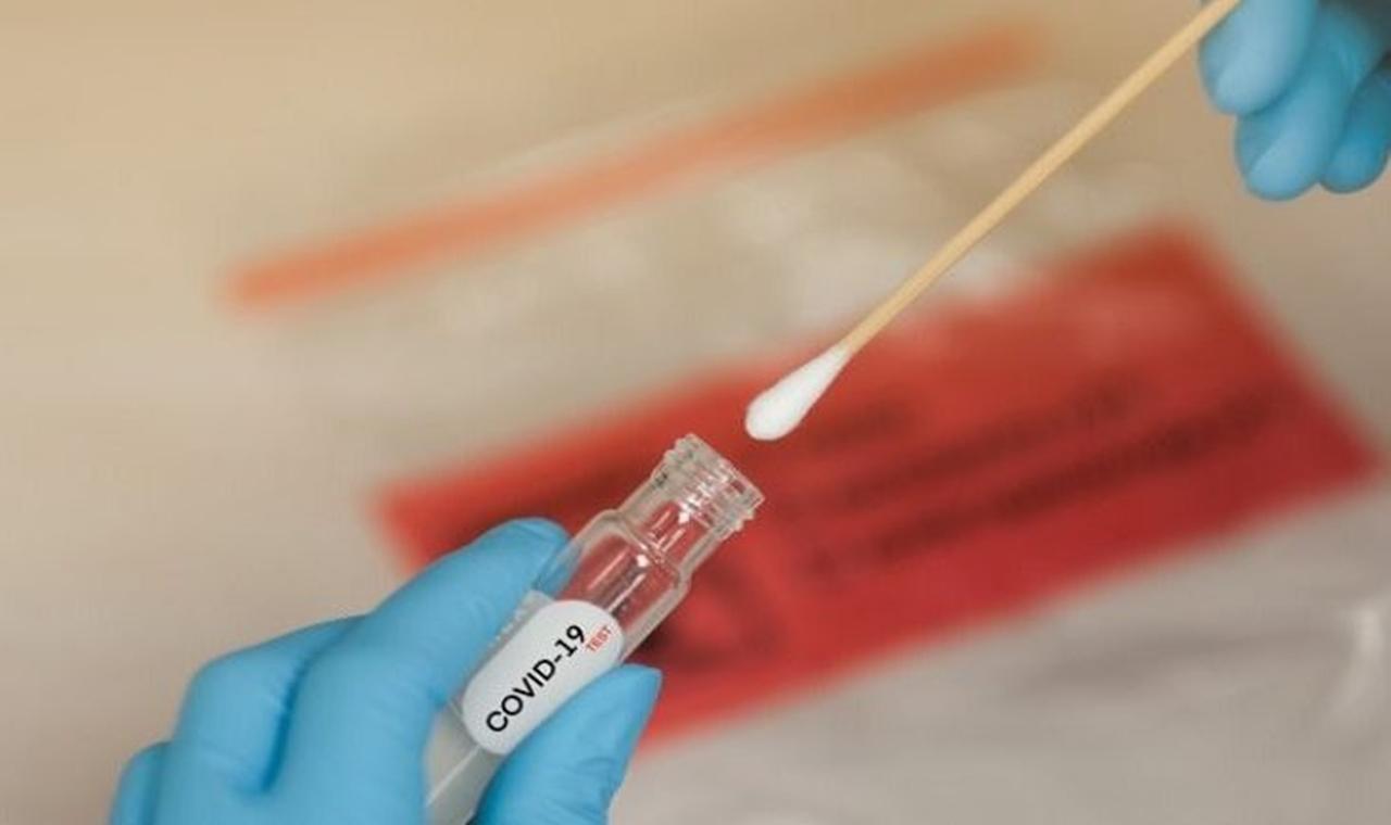 MS registra 536 novos casos e três mortes por Covid-19