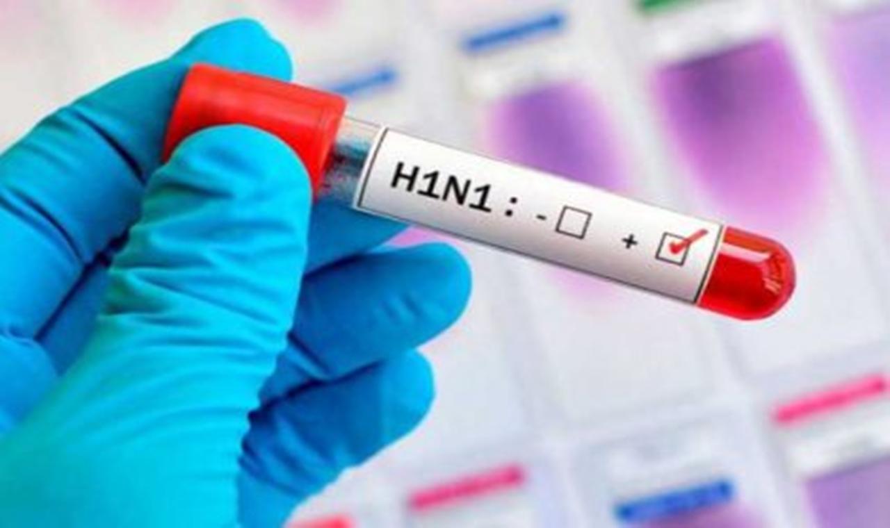 Três Lagoas registra um óbito por Influenza A – H1N1