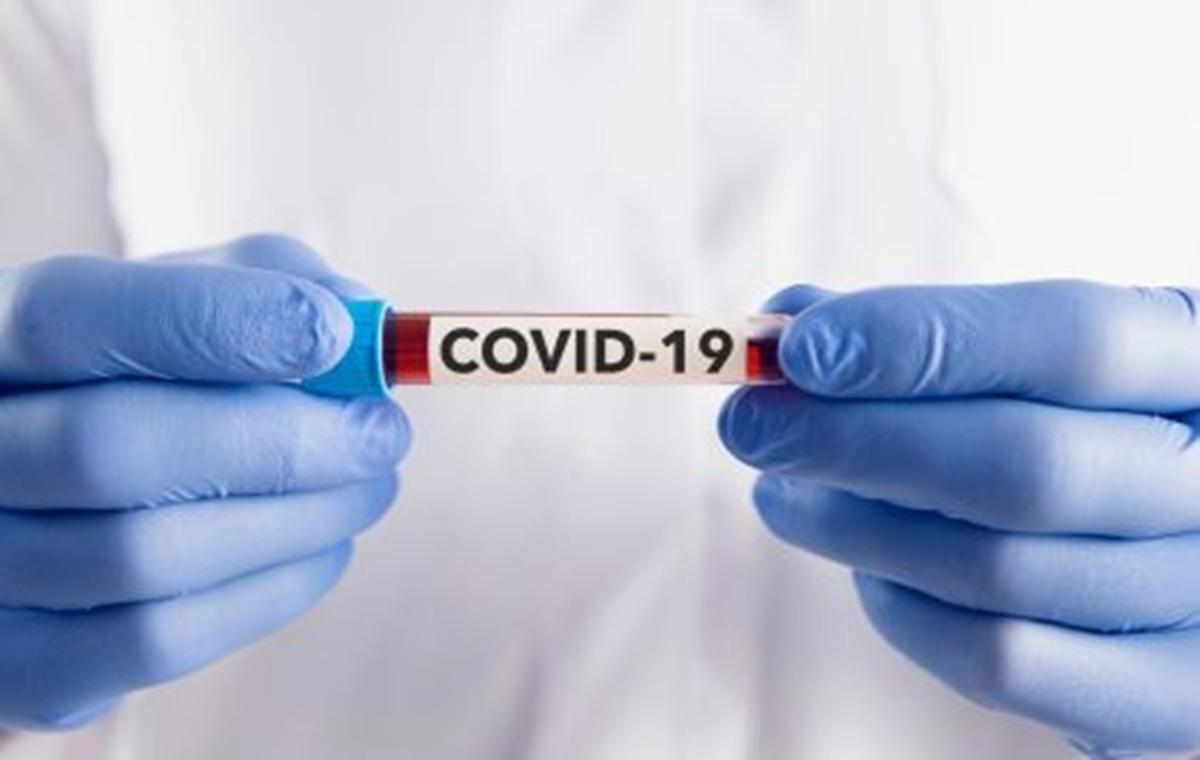 MS registra 601 novos casos e 7 óbitos de Covid-19 em uma semana