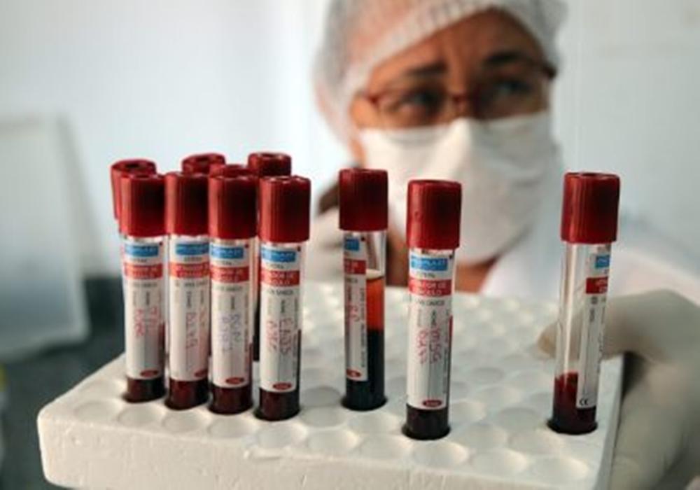 Para troca de equipamentos, Saúde reagenda coleta de alguns exames; veja para quando e quais