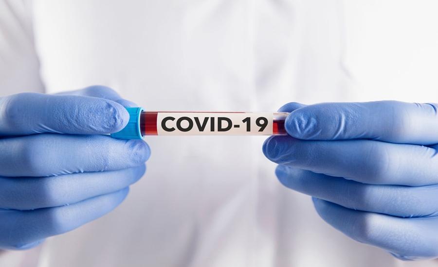 Covid-19 registra 995 novos casos na última semana em MS, com sete óbitos confirmados