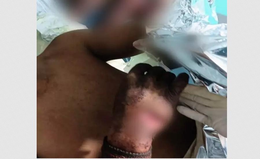 Rapaz de 22 anos tem dedos decepados durante briga de facão em festa