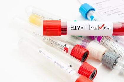 Aumentam casos de HIV em MS: 130 diagnósticos no primeiro semestre