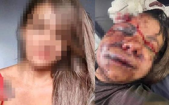 Ex-jogador de basquete é preso após espancar ex-namorada com mais de 60 socos no rosto