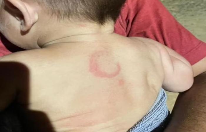 Pai é preso após espancar bebê de 4 meses em MS