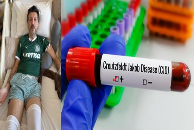 Entenda Doença de Creutzfeldt-Jakob, diagnóstico do piloto Lito Souza