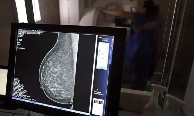 Tratamento oral contra câncer de mama avançado é aprovado no Brasil
