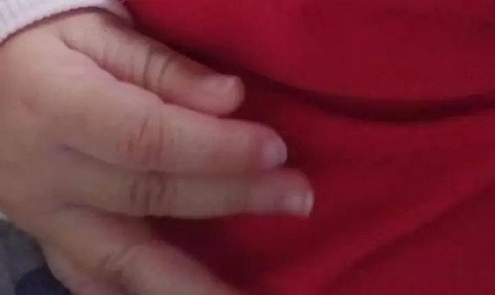 Bebê de 7 meses é internado com costela quebrada e lesão no crânio; mãe é presa em MS