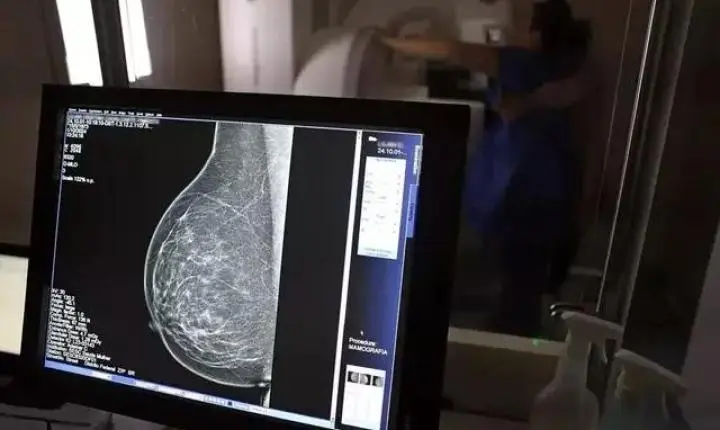 Tratamento oral contra câncer de mama avançado é aprovado no Brasil